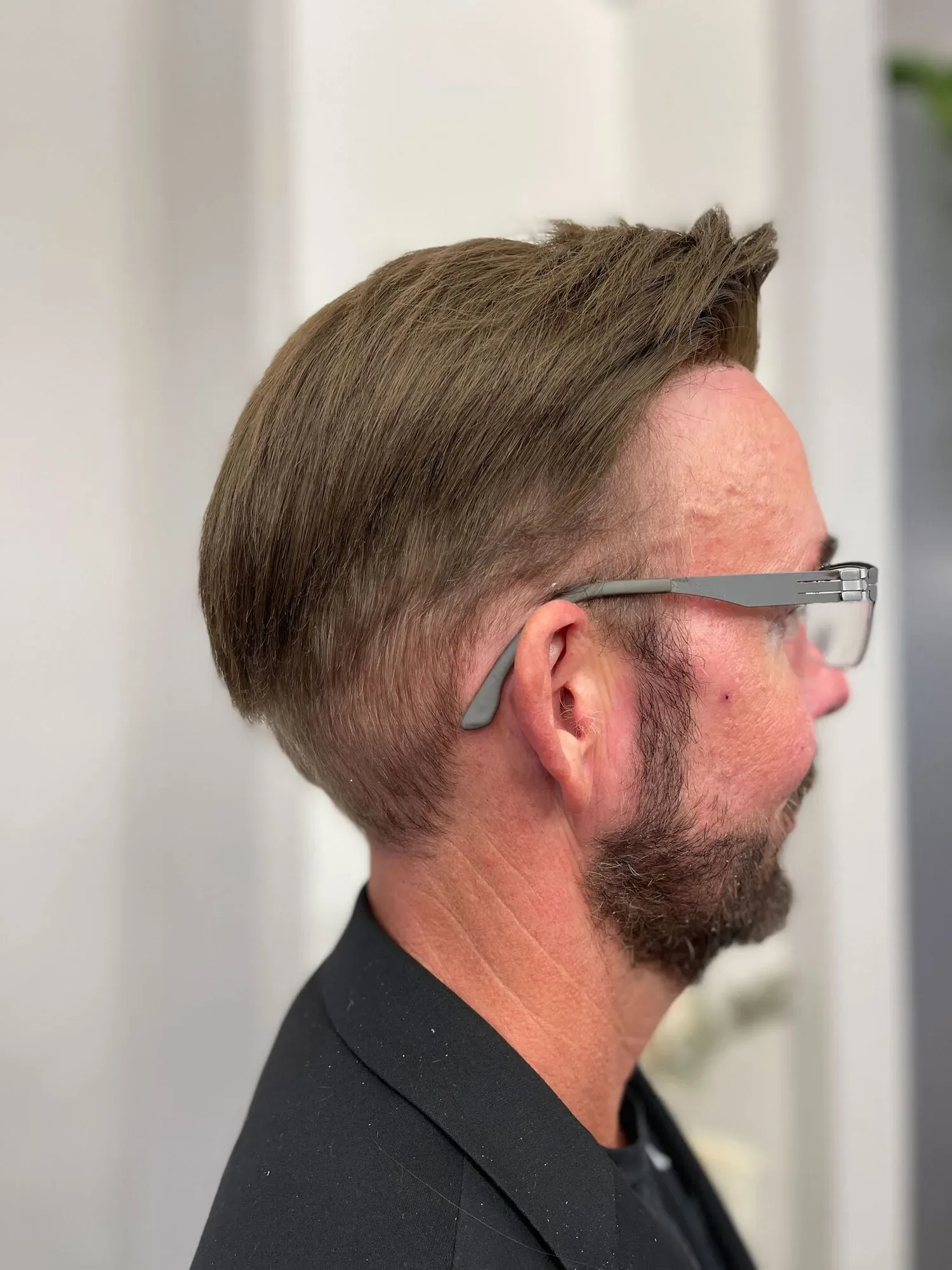 Haarsystem bei einem Mann im Profil, Übergang am Ansatz und über dem Ohr
